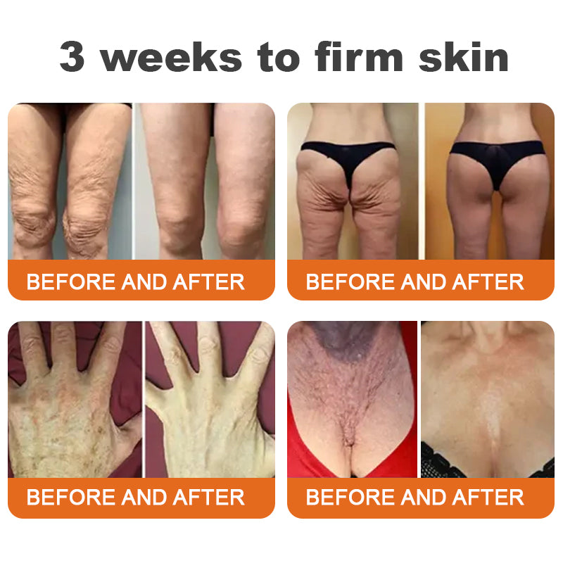 🧑⚕️🐝Made and Shipped from USA✨Flysmus™ Botox Bee Venom Firming Serum Stick🔥LAST DAY 70% OFF