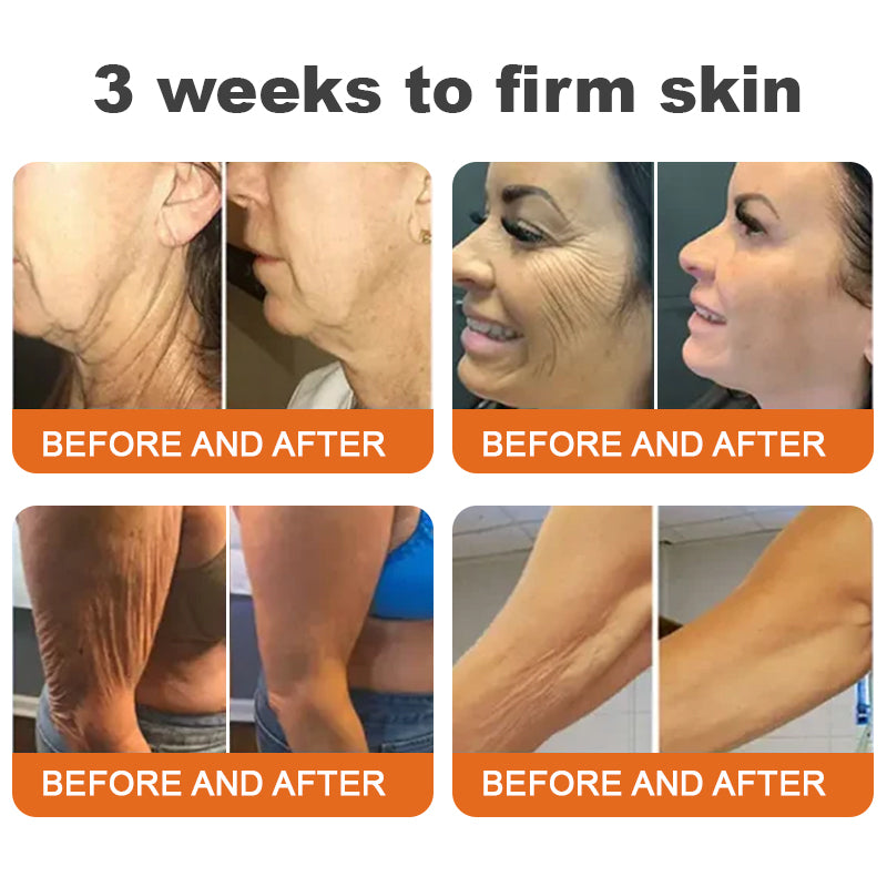 🧑⚕️🐝Made and Shipped from USA✨Flysmus™ Botox Bee Venom Firming Serum Stick🔥LAST DAY 70% OFF