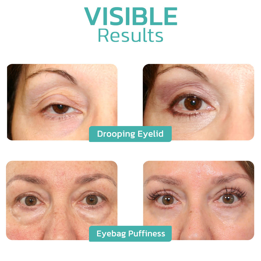 👩‍⚕️🌿Furzero™ CELYN Peptide Taut Eye Cream