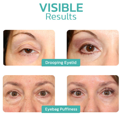 👩‍⚕️🌿Furzero™ CELYN Peptide Taut Eye Cream